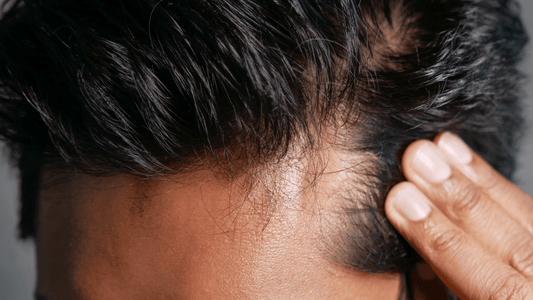 Le microbiote du cuir chevelu : comprendre l’écosystème qui influence la santé des cheveux - AUBE
