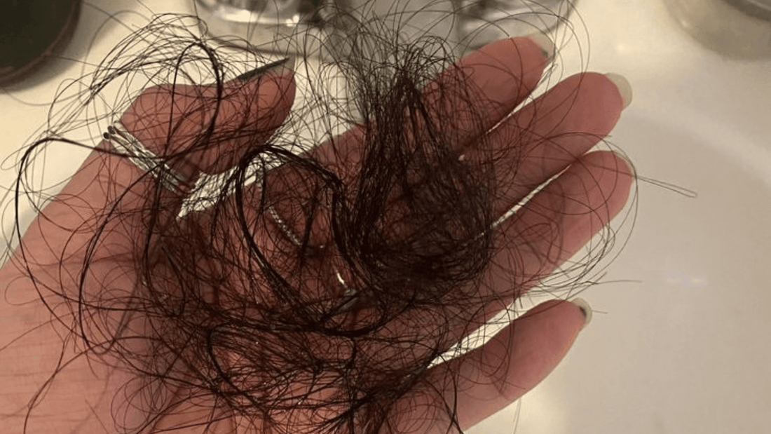 Peut-on inverser une chute de cheveux ? Routine de soin physiologique et massage du cuir chevelu Aube Care