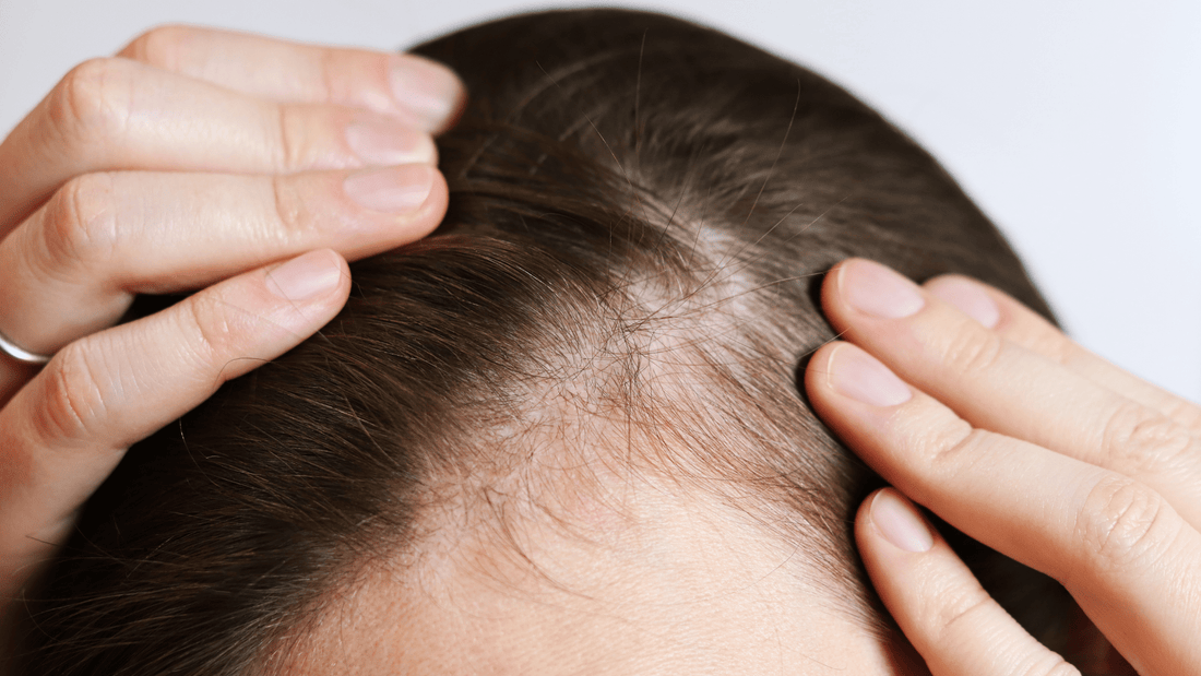 Quels sont les effets des hormones sur le cuir chevelu ? - AUBE